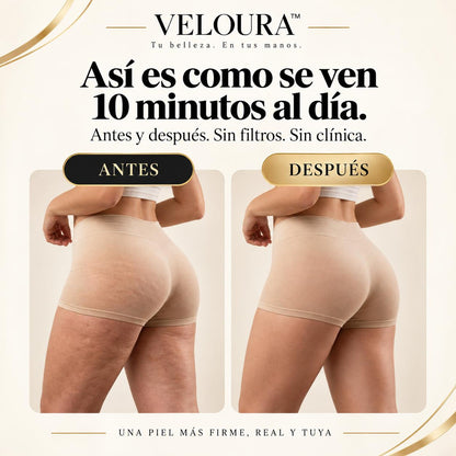 Masajeador Anticelulítico con Ventosa